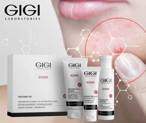 Gigi Acnon
